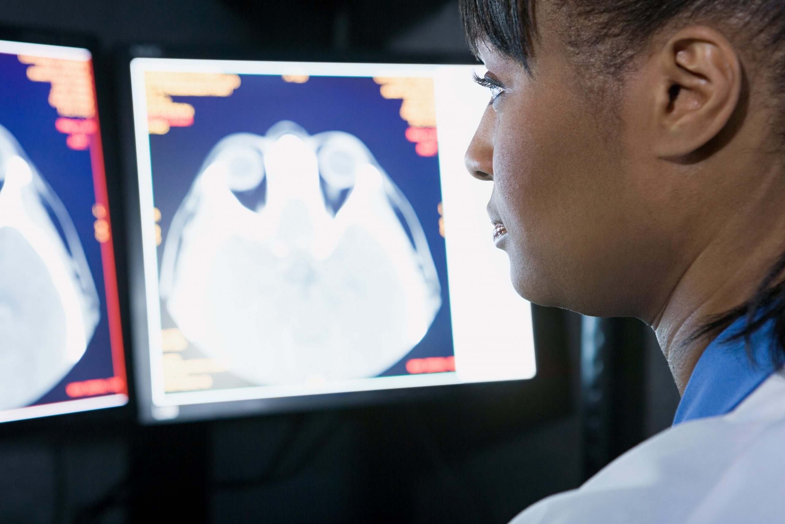 Cómo afecta la masturbación a tu cerebro